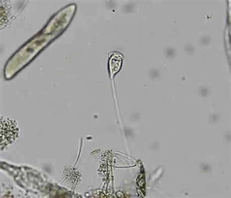  Vorticella: Mikä ero on elävällä ja kuolleella Vorticella-yksilöllä, kun molemmat näyttävät samalta mikroskoopin alla?